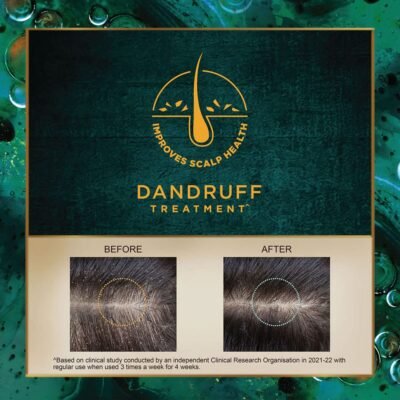 Indulekha Svetakutaja Oil|Ayurvedic Medicinal oil for dandruff treatment|100% Ayurvedic Oil