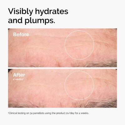 The Ordinary Hyaluronic Acid 2% + B5 Serum