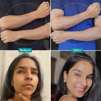 Pilgrim Peeling Solution - 10ml