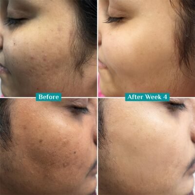 Pilgrim 10% Vitamin C Face Serum