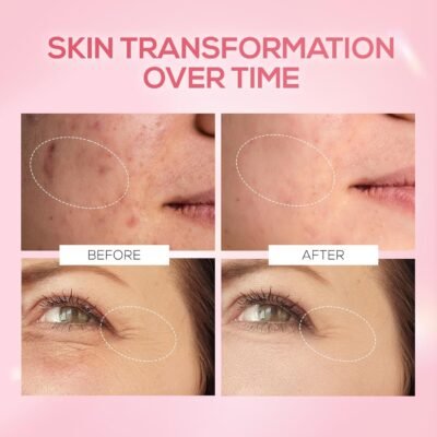 RENEE Pink Therapy Face Serum 30ml